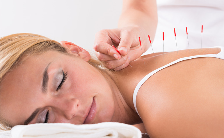 Spinal Cord Injury Rehabilitation